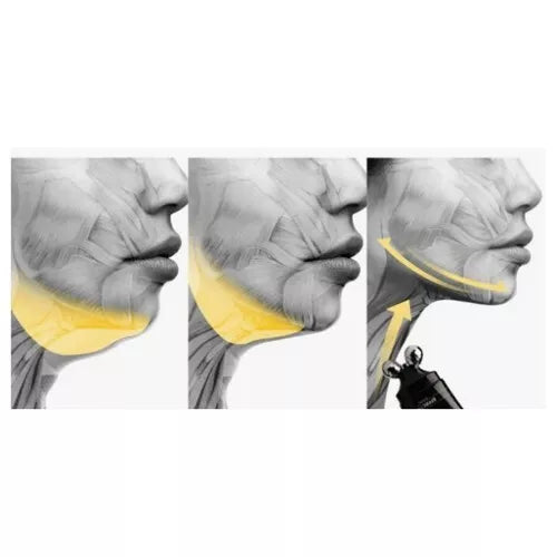 Bravity Effectra Medic Shaper – Soin Remodelant & Raffermissant Corps & Visage (100 ml)